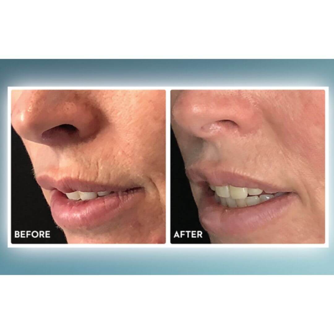 Healthy Skin With Daily Stem Cell Serum 